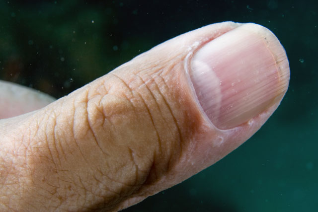 Thumb1.jpg