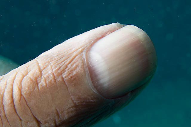 Thumb2.jpg